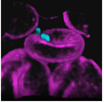 4D顯微鏡揭示瘧原蟲如何侵入紅細(xì)胞