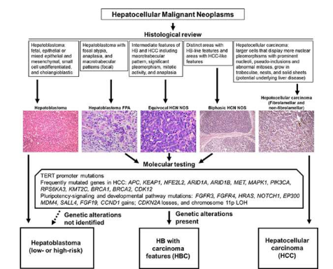 研究確定了兒童肝癌的新分子亞群