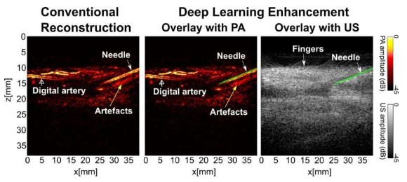 為光聲成像技術(shù)開(kāi)發(fā)的新型深度學(xué)習(xí)技術(shù)