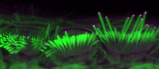 基因療法拯救了功能障礙的內(nèi)耳毛細(xì)胞
