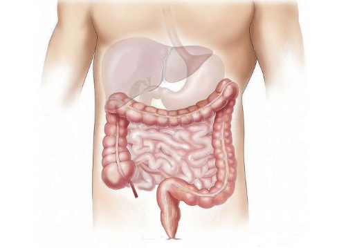 研究發(fā)現(xiàn)改善腸道再生和減輕放療副作用的關(guān)鍵機(jī)制