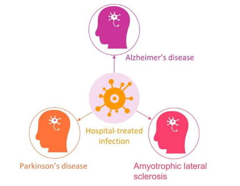 反復(fù)感染與某些神經(jīng)退行性疾病的風(fēng)險(xiǎn)增加有關(guān)