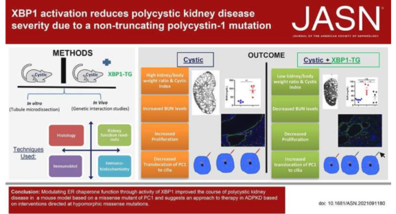 轉(zhuǎn)錄因子 XBP1 的激活可降低多囊腎病的嚴(yán)重程度