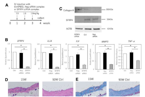 通過敲低 SFRP4 下調(diào)衰老相關(guān)分泌表型有助于預防皮膚老化
