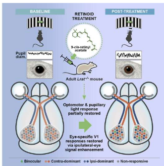 研究發(fā)現(xiàn)成人大腦有可能從遺傳性失明中部分恢復