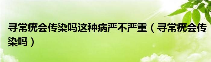 尋常疣會傳染嗎這種病嚴(yán)不嚴(yán)重（尋常疣會傳染嗎）