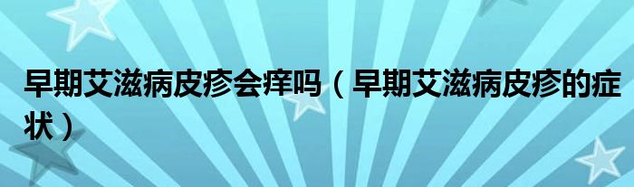 早期艾滋病皮疹會(huì)癢嗎（早期艾滋病皮疹的癥狀）