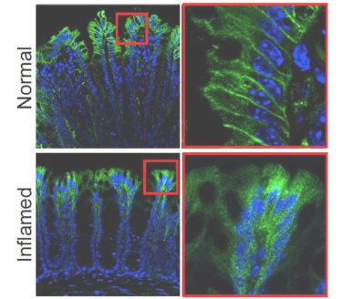 科學(xué)家揭示結(jié)腸疼痛和炎癥的機(jī)制