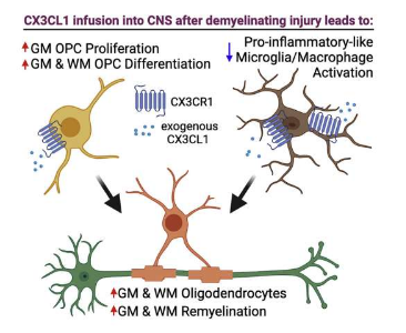 研究人員朝著發(fā)現(xiàn)大腦分子如何阻止 MS 邁出了又一步