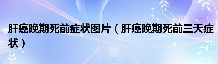 肝癌晚期死前癥狀圖片（肝癌晚期死前三天癥狀）