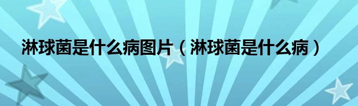 淋球菌是什么病圖片（淋球菌是什么?。?class='thumb lazy' /></a>
		    <header>
		<h2><a  href=