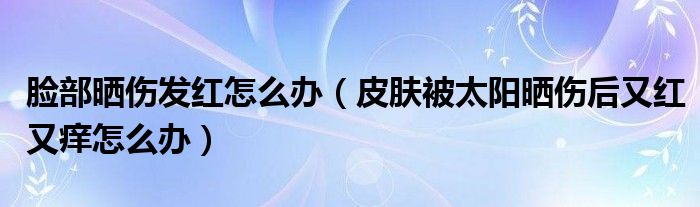 臉部曬傷發(fā)紅怎么辦（皮膚被太陽(yáng)曬傷后又紅又癢怎么辦）