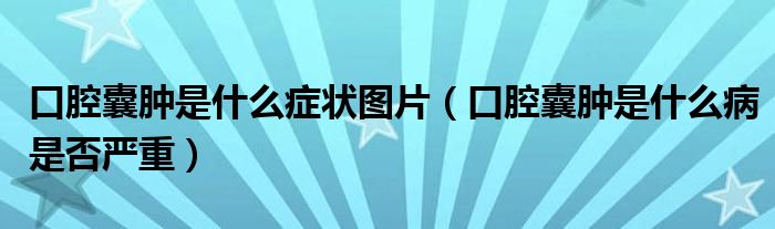 口腔囊腫是什么癥狀圖片（口腔囊腫是什么病是否嚴(yán)重）