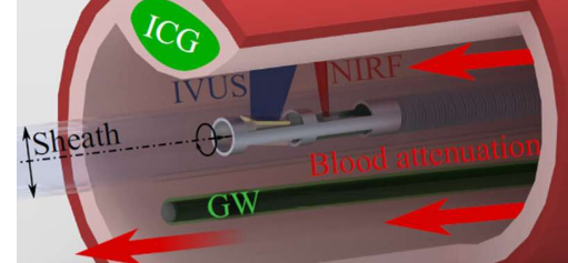 提高近紅外熒光在心血管成像中的準(zhǔn)確性