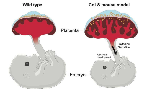 胎盤中持續(xù)的 DNA 損傷會影響妊娠結局