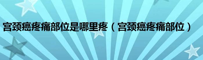 宮頸癌疼痛部位是哪里疼（宮頸癌疼痛部位）