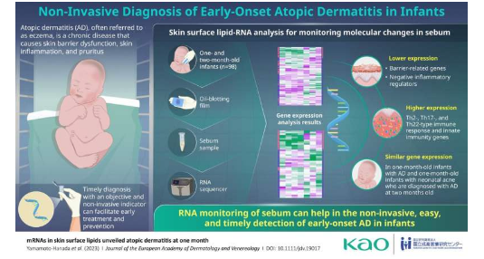 一種利用皮脂診斷早發(fā)性特應(yīng)性皮炎的新方法