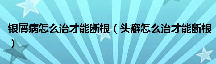 銀屑病怎么治才能斷根（頭癬怎么治才能斷根）