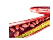 研究人員開發(fā)新系統(tǒng)來確定家族性高膽固醇血癥的新療法