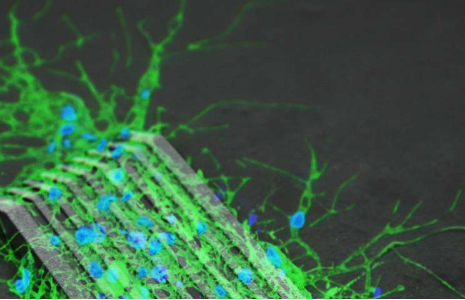 微型機(jī)器人用于在大鼠神經(jīng)細(xì)胞網(wǎng)絡(luò)之間架起橋梁