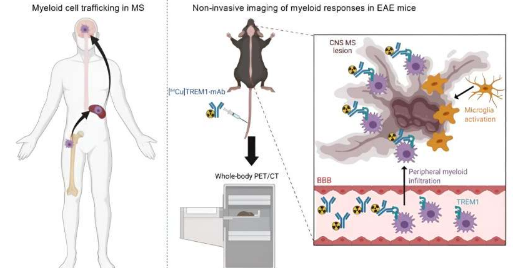 研究人員發(fā)現(xiàn)分子信號(hào)可以幫助確認(rèn)多發(fā)性硬化癥的早期診斷