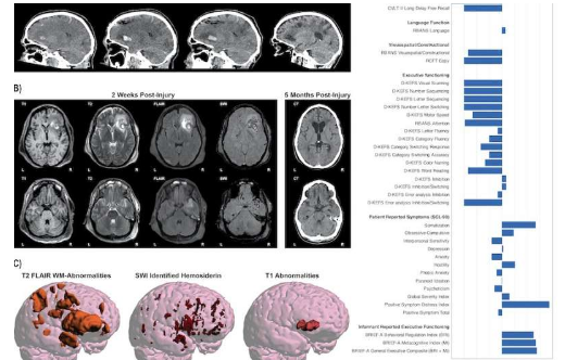 全球 MRI 數(shù)據(jù)為改善腦損傷治療帶來希望