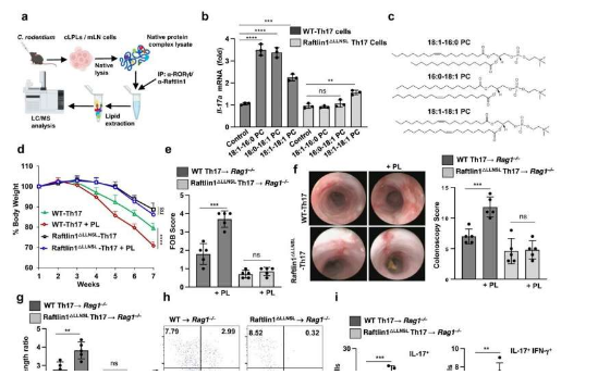 研究人員確定炎癥性腸病的驅動因素