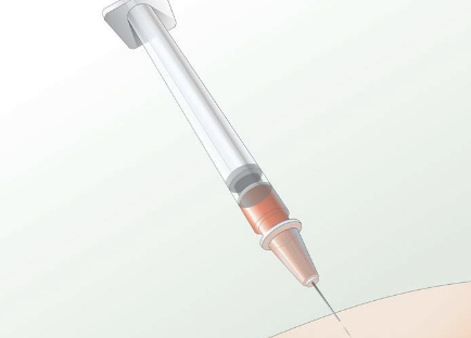 新測量技術(shù)顯示 T 細(xì)胞與衰老之間的聯(lián)系