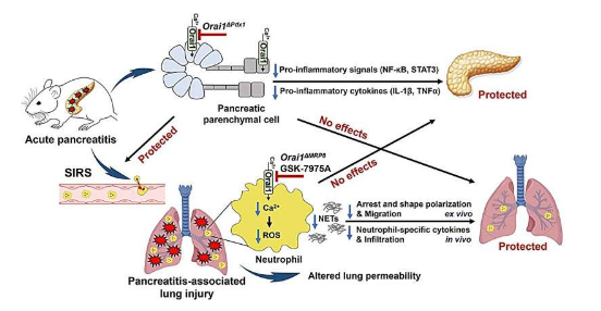 改變關(guān)鍵離子通道可預(yù)防胰腺炎相關(guān)的急性肺損傷