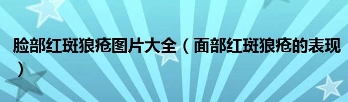 臉部紅斑狼瘡圖片大全（面部紅斑狼瘡的表現(xiàn)）