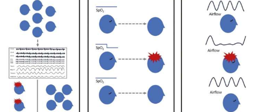 睡眠期間低氧和睡眠呼吸暫停與老年人癲癇有關(guān)
