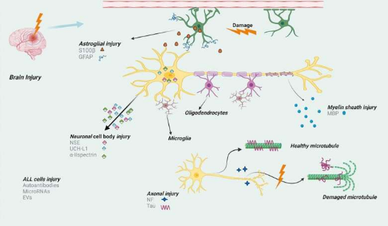 科學(xué)家描述了與腦損傷相關(guān)的生物標(biāo)志物