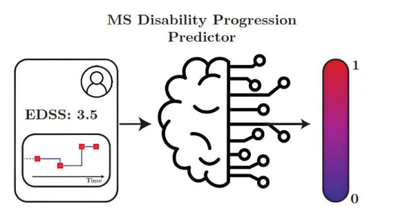 機器學習顯示出預測多發(fā)性硬化癥進展的潛力